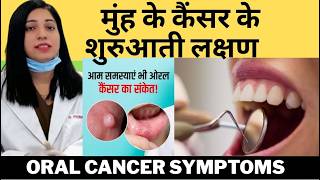 मुंह के कैंसर के शुरुआती लक्षण | Early Symptoms Of Oral Cancer |