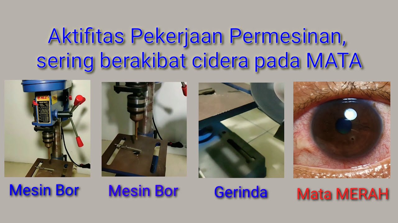 MENGATASI MATA KELILIPAN SERBUK BESI DENGAN MAGNET DAN MENGATASI MATA KELILIPAN SERBUK BESI DENGAN MAGNET DAN
