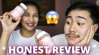 1 WEEK OF USING VITABEARS (EFFECTIVE?) | Vitabears Chewable Skin Vitamins Review