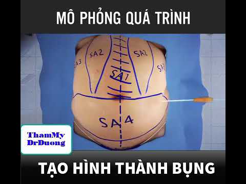 Video Hút mỡ và tạo hình thành bụng như thế nào? - youtube