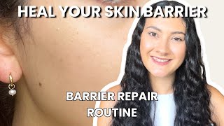 HOW To Heal Your Skin Barrier in 2026