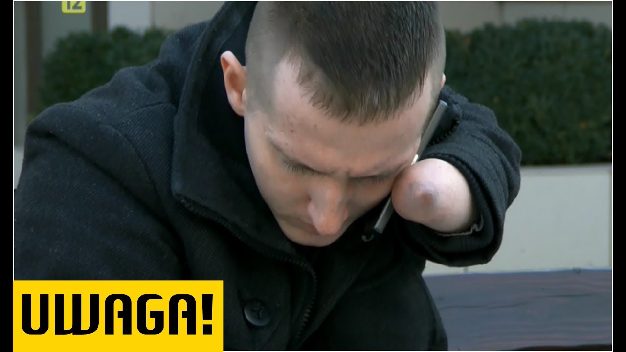 Kamil czeka na przeszczep ręki