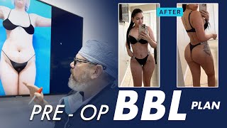 Optimizing the Shape of Your Body with a BBL