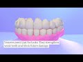 Worn Teeth: The Expert Fixes You've Probably Never Heard Of