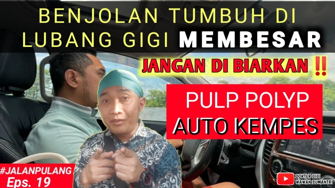 🔴 CARA MENGHILANGKAN DAGING DALAM GIGI BERLUBANG ~POLYP ROOT CANAL TREATMENT #pulpapolip #pulppolyp