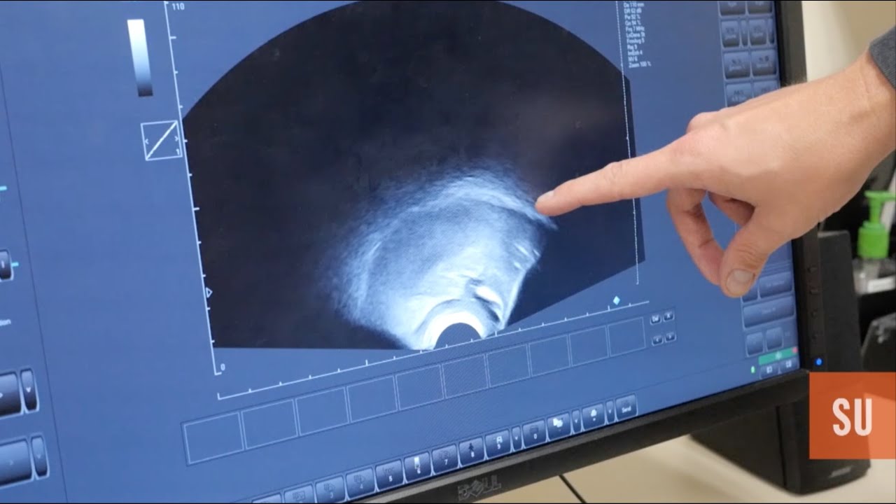 Robotic speech picture