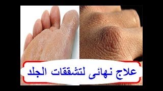 # وصفة زيت الزيتون وجل الصباح لتخلص من تشققات الجسم #وصفات منزلية لجمالك _homemede beauty recipes