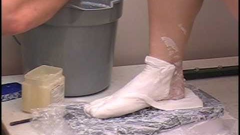 ACOR- Custom Footwear Casting- Posterior Opening