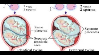 مراحل نمو التوائم في بطن الأم