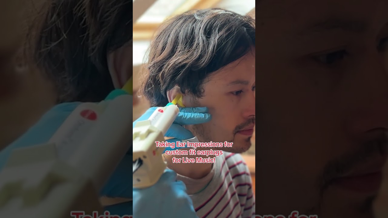 Taking ear impressions for custom fit ACS earplugs for listening to Live Music.