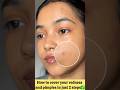 Day:-13/30Days✅ challenge makeup tips and trick  #pimple  #redness  #makeup #shorts #shortsfeed #fyp