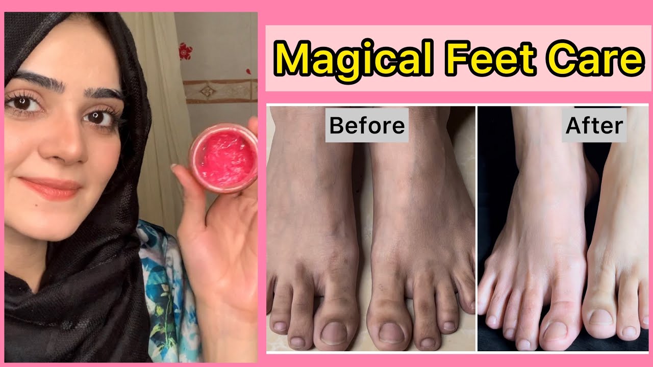 Best Feet Care In Winter 2021 Remove Dullness And Dry Skin Feet