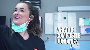 Composite Bonding with Dr. Kate | FAQ | Smile Makeover | The Dental House 🦷✨
