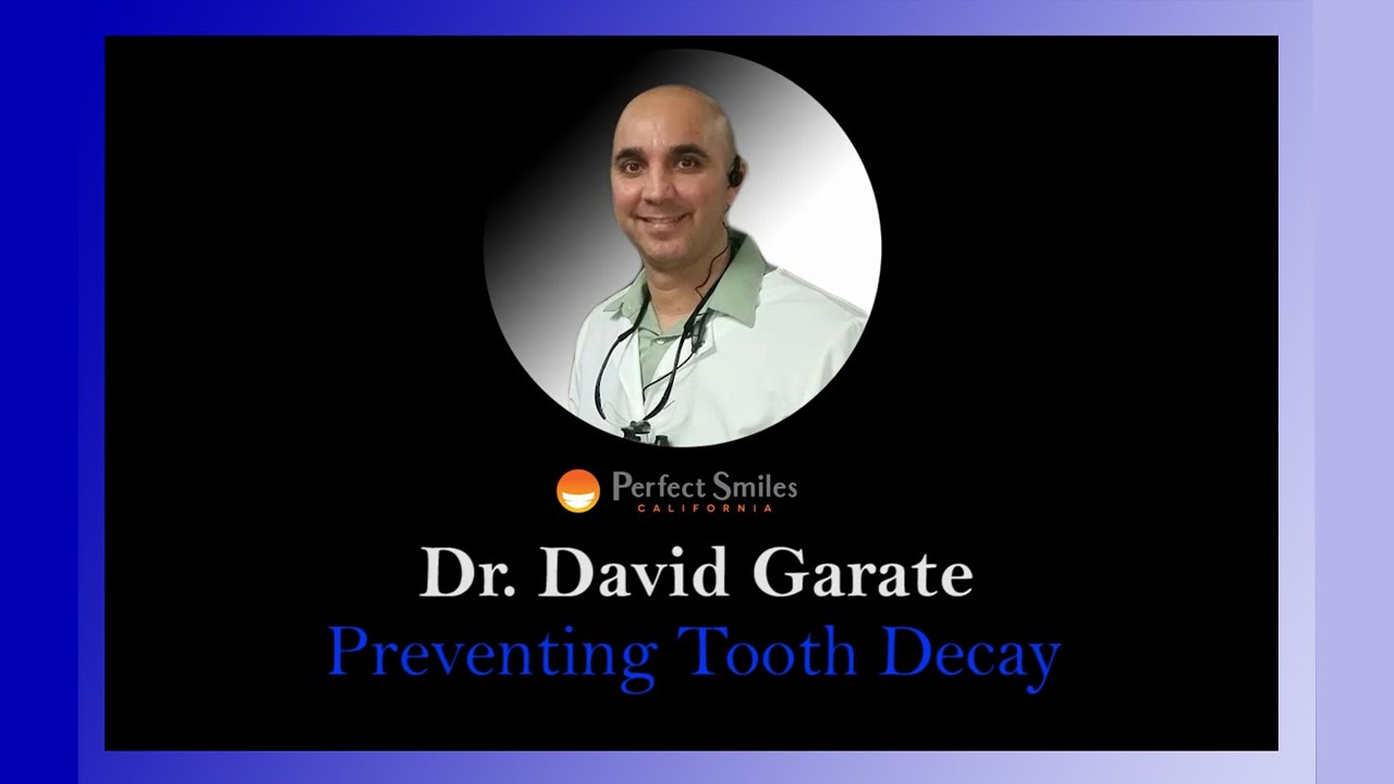 Affordable Dental Sealants Chula Vista CA| Dentist Chula Vista CA| Dr. David Garate