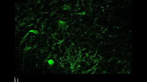 In-Vivo Calcium Imaging