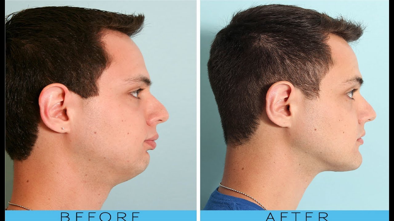 For a jawline tips better Tips For