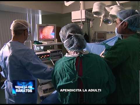 Video: Este dureroasă operația de apendice?