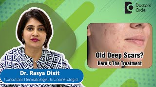 Treatment Of Deep Old Acne Scar for Clear Skin #acne #pimple   - Dr. Rasya Dixit | Doctors