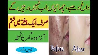 How To Remove Dark Spots Naturally - (Dark Spots) ka Desi Ilaj