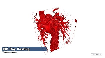 Atomicus Chart: Volume rendering features
