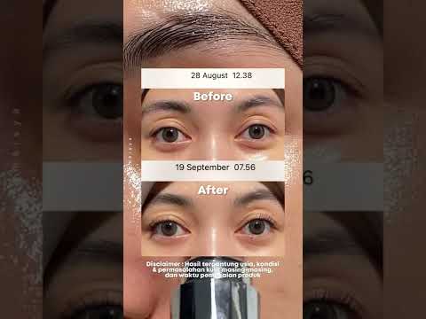 Jangan males pake eye cream! ✨ | #widymeisya #rekomenwidsky #racunwidmey #skintific #skintificwidy