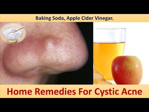 Home Remedies For Cystic Acne - Baking Soda., Apple Cider Vinegar.