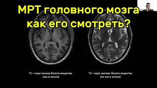 видео: МРТ головного мозга, как его смотреть? Михаил Михайлович Берегов. картинка: МРТ головного мозга, как его смотреть? Михаил Михайлович Берегов.