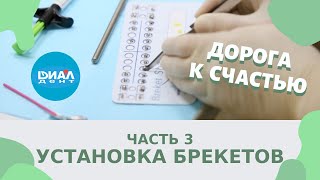 Установка брекетов, чистка зубов - третья серия проекта 