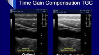 Physics of Ultrasound: Pulse Echo US - Segment #3