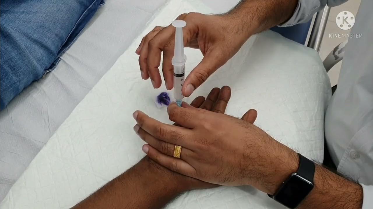 TRIGGER FINGER STEROID INJECTION/ DR PRADEEP BALA YouTube