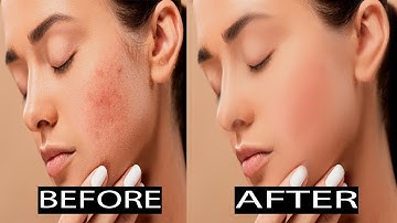 How To Remove Pimples  From Photos | Best Blackhead Removal Apps |  Autodesk Sketchbook Face Smooth