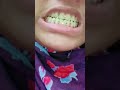 aisi halat Hai Meri aa tujhe Main bataun #funny 👌👌