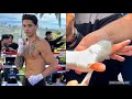 WATCH &amp; LEARN HOW RYAN GARCIA WRAPS HIS HANDS BEFORE BOXING &amp; TRAINING FOR GERVONTA DAVIS