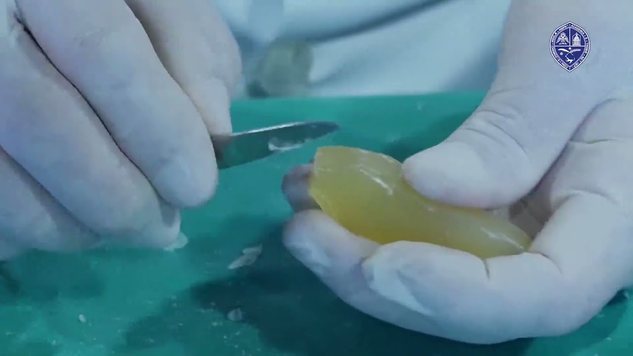 TALLADO DEL CANINO  SUPERIOR UASD