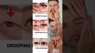 EYE AREA REJUVENATION 🔥 #eyes #undereyedarkcircle #droopyeyelids  #antiaging