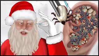 ASMR Merry Christmas Help Santa Claus clean his ears | Ear Cleaning Animation | Universe ASMR