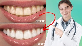 10 Natural Ways to Whiten Teeth at Home |Health News