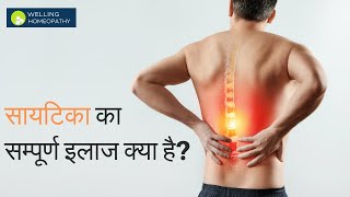 सायटिका का सम्पूर्ण इलाज क्या है? #sciatica #sciaticanervepain #sciaticatreatment