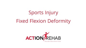 Sports Injury - Fixed Flexion Deformity - Action Rehab