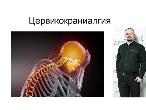 Цервикокраниалгия – головная боль вызванная проблемами в шее.