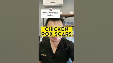 Thumbnail of Treating Chicken Pox Scars #shorts