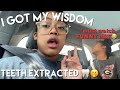 I GOT MY WISDOM TEETH REMOVED VLOG