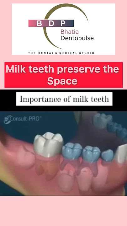Why are Milk teeth Important? #babyteeth #baby #teeth #kidsdentist