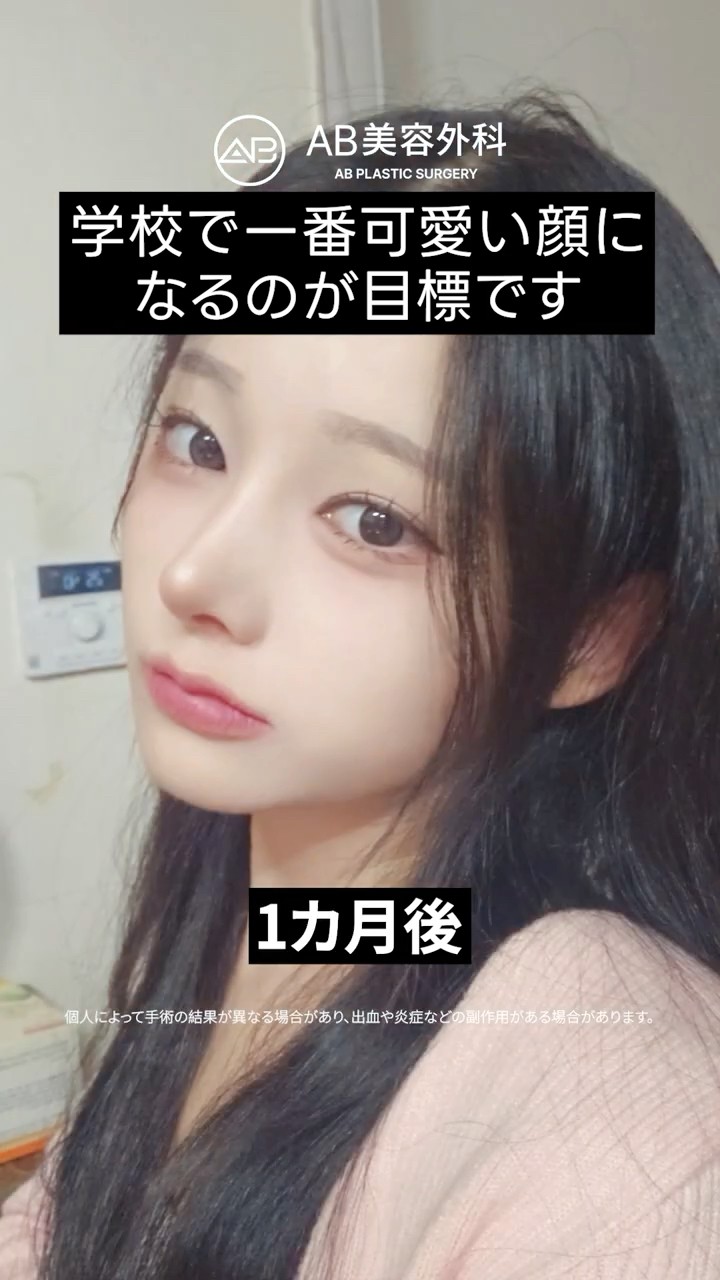 目元と鼻が変わると、こんなに垢抜ける✨ #Shorts
