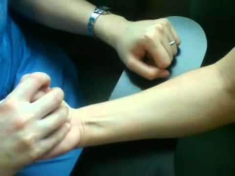 Tendinitis cubital posterior tratamiento