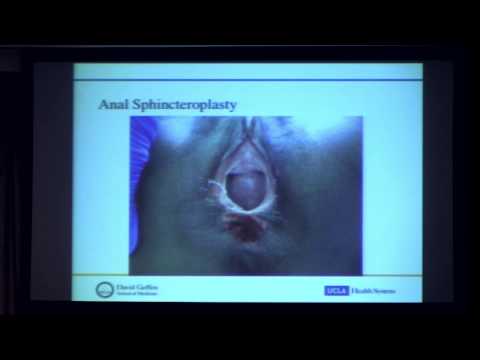 Functional Disorders of the Ano–rectum | Christopher Tarnay, MD | UCLA Digestive Disease