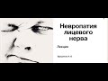 Невропатия лицевого нерва