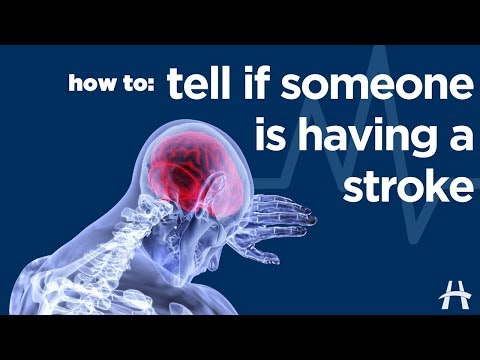 How to tell if someone is having a stroke