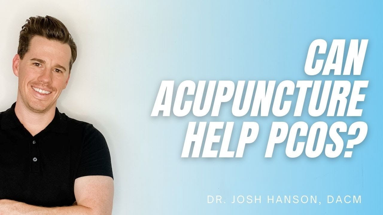 Can Acupuncture Help PCOS? YouTube