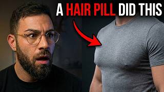 I Got Man Boobs From Dutasteride. Here's Your Real Risk on Finasteride Too